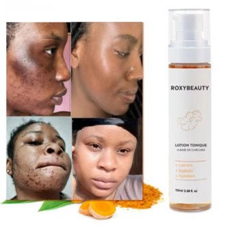 🌿 Tonique Visage 3-en-1 au Curcuma – RoxyBeauty
