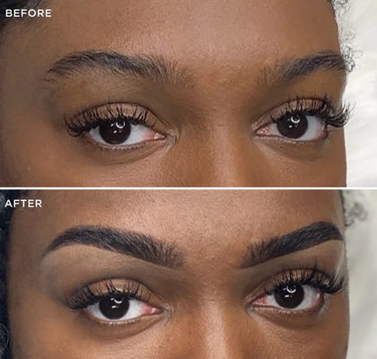 BROWLIFT