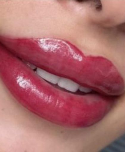 CANDY LIPS