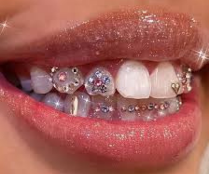 STRASS DENTAIRE